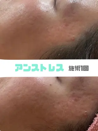 セラピエール 石川のエステ・リラクイメージ