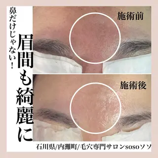 salon soso(ソソ)のエステ・リラクイメージ