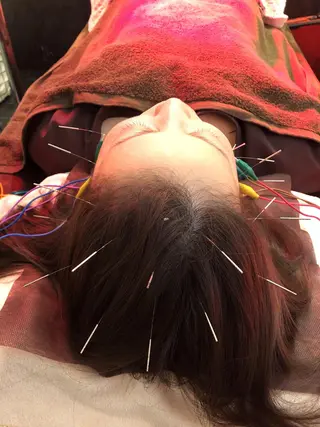 小顔矯/美容鍼/鍼灸 BeauJuのその他イメージ