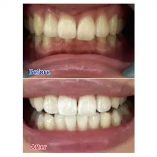 Ｍ渋谷 ホワイトニングのエステ・リラクイメージ