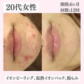 ニキビ・肌質改善専門 ♡人生が変わるサロンのエステ・リラクイメージ