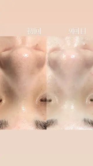 🆕✨　𝑬𝑹𝑰 南大塚の美肌改善のエステ・リラクイメージ