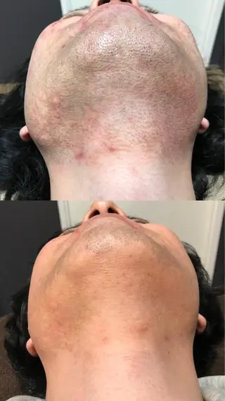 Lilyboo 星のエステ・リラクイメージ