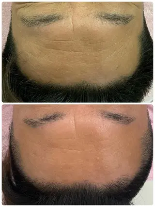 Salon Rion所属・Rion 野々村のエステ・リラクイメージ