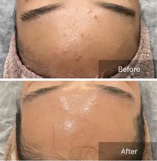 肌管理／眉毛．まつ毛 陽子の眉毛・アイブロウイメージ