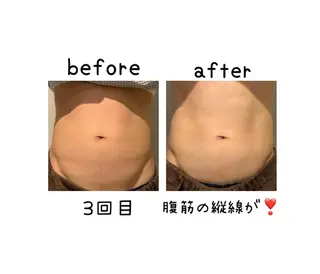 メンズ 癒し腸もみサロン シャユーム　ゆきなのその他イメージ