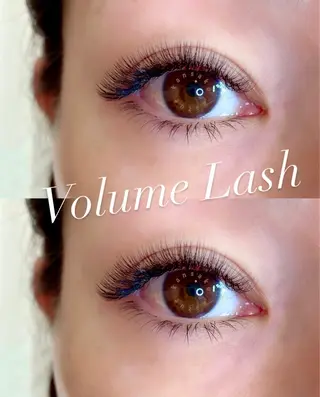 マツエク・マツパ 医療提携美容サロン Beatrice 五反田所属・医療提携美容サロン Beatriceのエステ・リラクイメージ