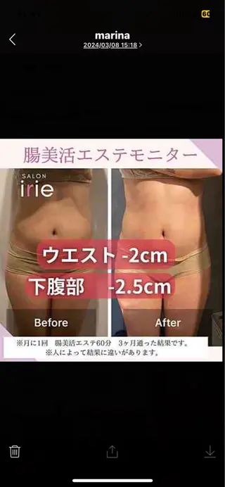 腸活/クビレを作る /痩身エステのエステ・リラクイメージ