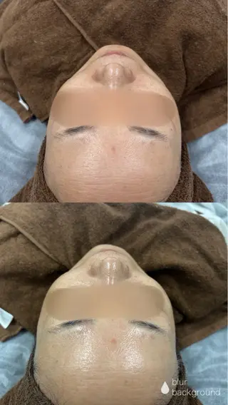 肌質改善|美眉サロン Cannone’のエステ・リラクイメージ