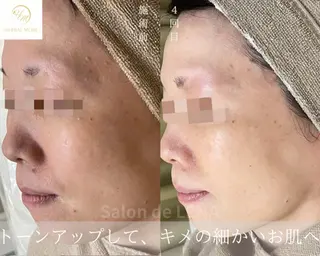 ハーブピーリング専門 サロンドレナ平岡のエステ・リラクイメージ