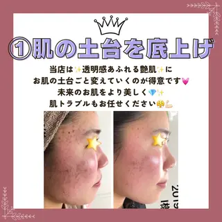 Prima 〜プリマ栄店〜のエステ・リラクイメージ