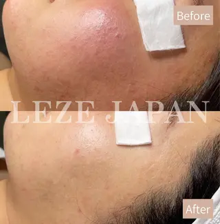 Lilyboo 池袋のエステ・リラクイメージ