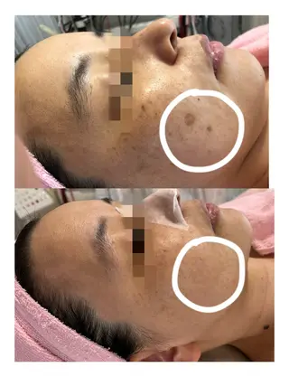 顔専門エステ プリエールビューティのエステ・リラクイメージ