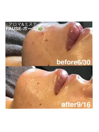 浜野 恵美のエステ・リラクイメージ