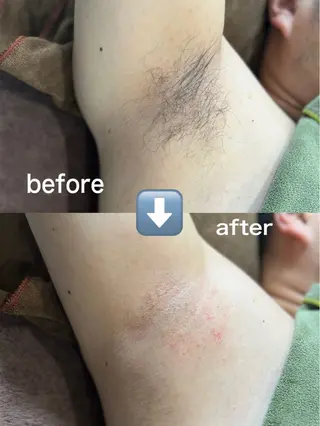 メンズ effet エフェのエステ・リラクイメージ