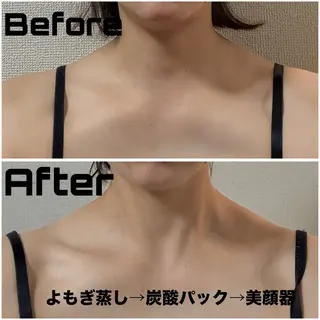東三国/新大阪 敏感肌×小顔サロンのエステ・リラクイメージ
