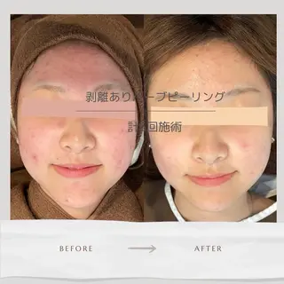 Life Salon別府店のエステ・リラクイメージ