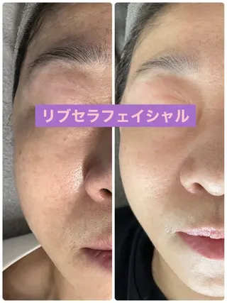 プライベートサロン プリュネルのエステ・リラクイメージ