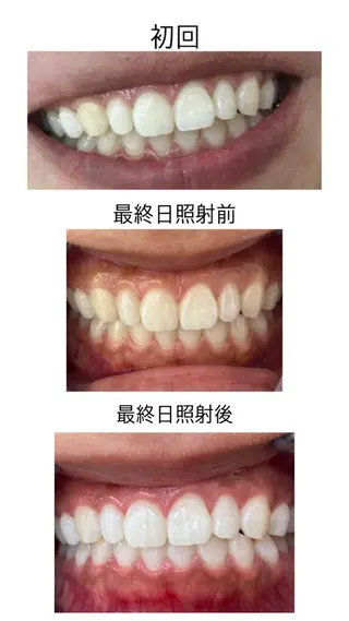 セルフホワイトニングサロンエクシアホワイト倉敷店所属・ecxiawhite 倉敷店のエステ・リラクイメージ