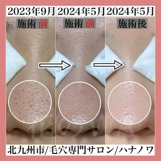 毛穴&リンパマッサー ジ専門サロン花のWAのエステ・リラクイメージ