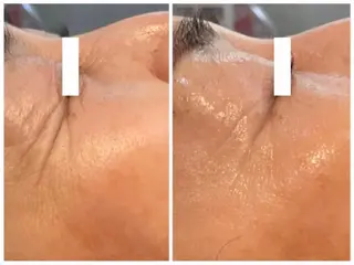 Sha.Lu.Lu.所属・本気の肌質改善/ ハーブピーリングのエステ・リラクイメージ