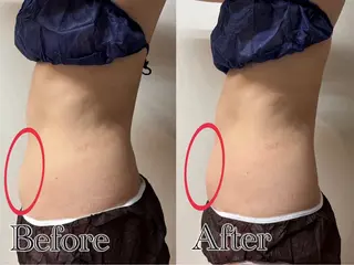 🌸🧡六本木 脱毛しずか🧡🫧の眉毛・アイブロウイメージ