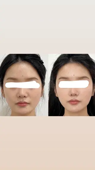 マツエク・マツパ 愛維美水光美肌専門店 メンズレディースokのエステ・リラクイメージ