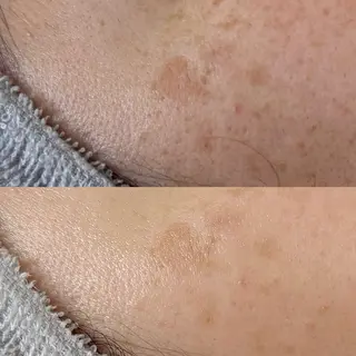 Rairy Salon富士見町のエステ・リラクイメージ