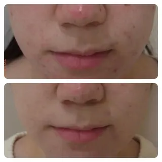 肌質改善専門 鈴木悠のエステ・リラクイメージ