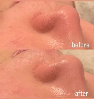 トラブル肌改善🏥 Meow！🫧🫧のその他イメージ