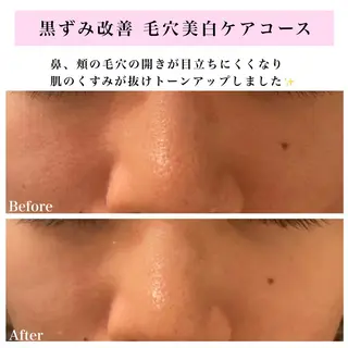 Bellesthe (ベルエステ)のエステ・リラクイメージ