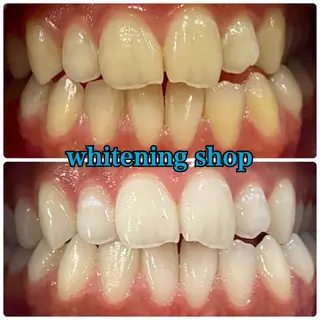 ホワイトニング ショップ津店のその他イメージ