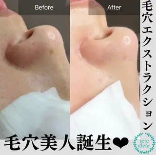 beauty salonWのエステ・リラクイメージ