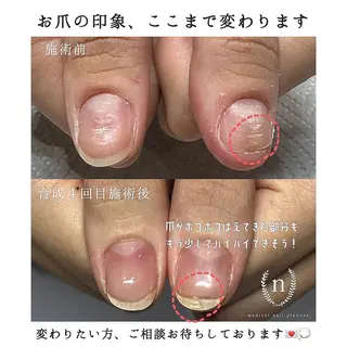 ネイル 自爪育成専門サロン ◌𓈒azumiのネイルデザイン
