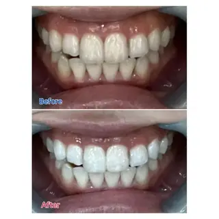 Ｍ渋谷 ホワイトニングのエステ・リラクイメージ