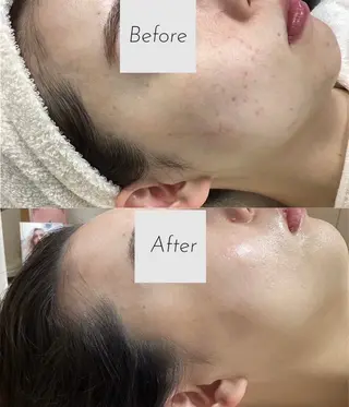 都度払い 肌質改善専門サロンのエステ・リラクイメージ