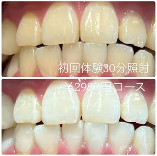 ホワイトニングルーム 横浜店のその他イメージ