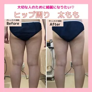 三沢市エステサロン Sブランペタルのエステ・リラクイメージ