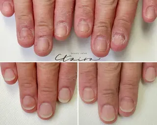 メンズ ネイル 深爪矯正専門店　ネイルサロン　トイロ所属・ネイルサロン トイロのネイルデザイン