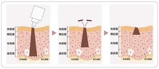 曽根 理奈のエステ・リラクイメージ