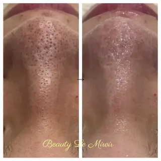 ビューティー ミロワールのエステ・リラクイメージ