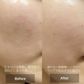 メンズ キッズ 美肌と癒しのサロン Lu,Mieのエステ・リラクイメージ