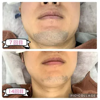 メンズ REONZ取手店所属・REONZ 取手店のエステ・リラクイメージ