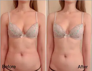 nin feaのエステ・リラクイメージ