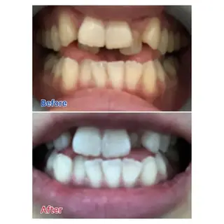 M渋谷 ホワイトニングのエステ・リラクイメージ