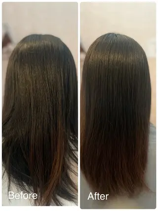 姫路/肌質改善 /やまもとのエステ・リラクイメージ