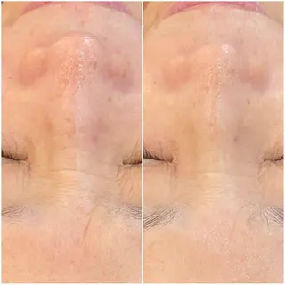 パーソナルスキンケア 🦋APRI🅿️有のエステ・リラクイメージ