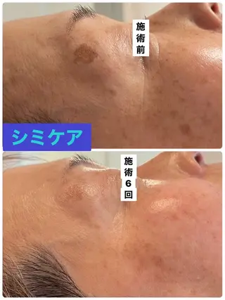 プライベートサロン プリュネルのエステ・リラクイメージ