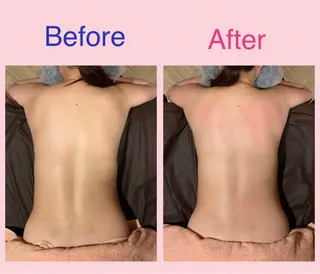 Rewhite -リホワイト-のエステ・リラクイメージ