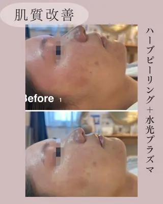 小顔＆肌質改善 NICORIのエステ・リラクイメージ